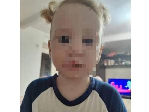 В Азове ищут доноров крови для двухлетней девочки, пострадавшей в ДТП